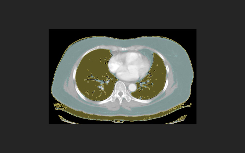 #3. DICOM Viewer+ (macOS) Podle: 远腾 李