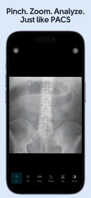Learn X-Ray Radiology screenshot 3