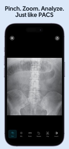 Learn X-Ray Radiology Screenshot 3 of 5