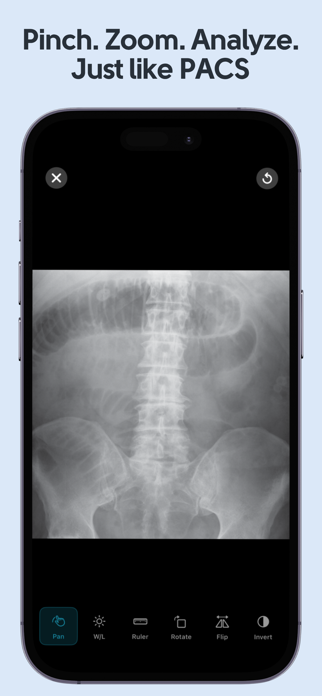 Learn X-Ray Radiology Screenshot 3 of 5