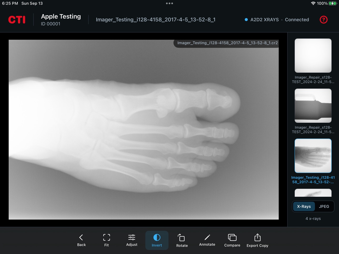 Screenshot 2 of CTI A2D2 Remote X-Ray Viewer