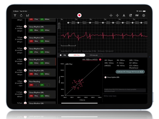 Screenshot #4 pour ECG+ | Analyse QTc, HRV & FA