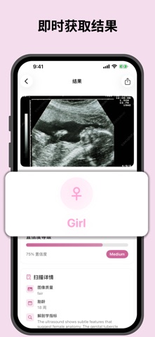 Baby Gender Scanner AI Pro screenshot