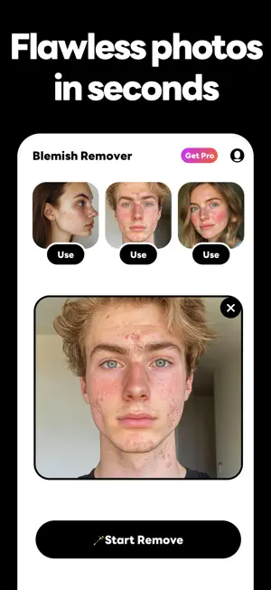Blemish Remover : AI Remove screenshot 4