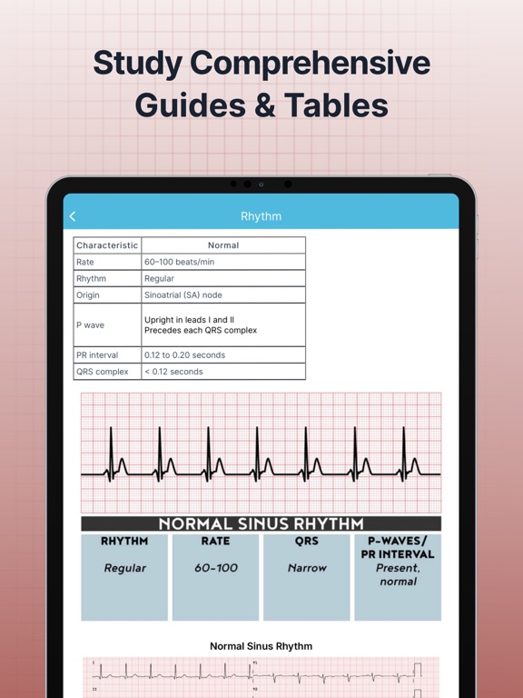 Screenshot #6 pour ECG EKG Interpretation Mastery