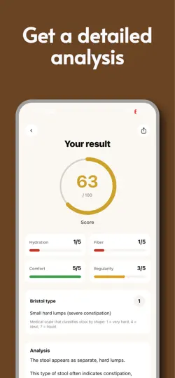 Screenshot von Poop AI – Gut & Stool Tracker auf dem iPhone 2