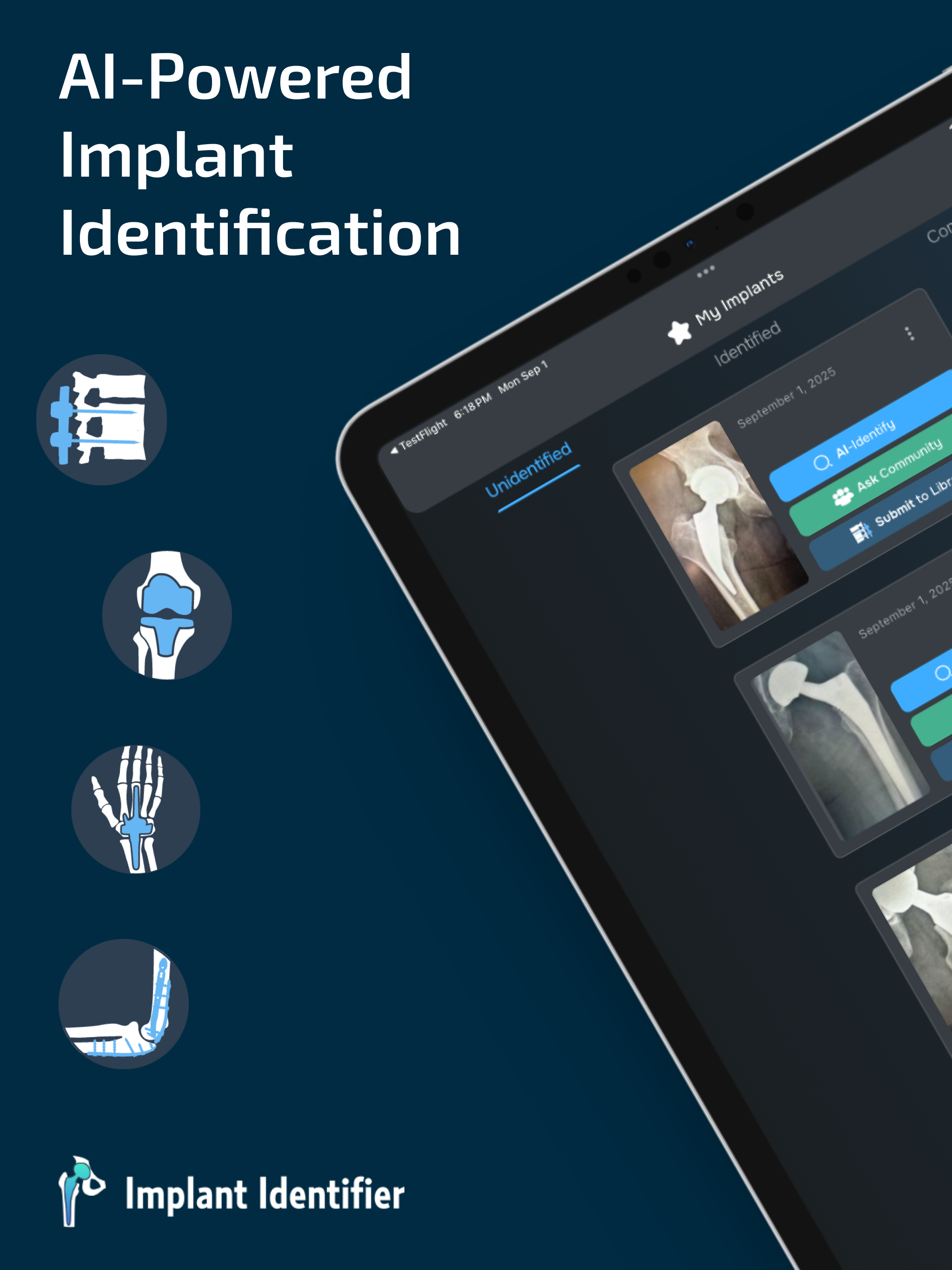 Implant Identifier