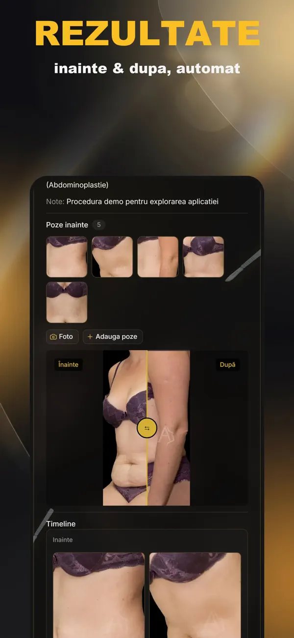 Screenshot #1 pour AestheticFollow