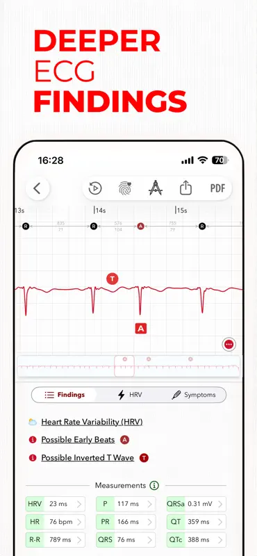 ECG+ | Interpretación de ECG screenshot 10 of 10