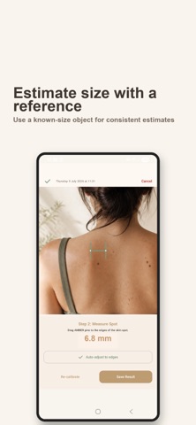 Skin Tracker: Photo Journal screenshot 4