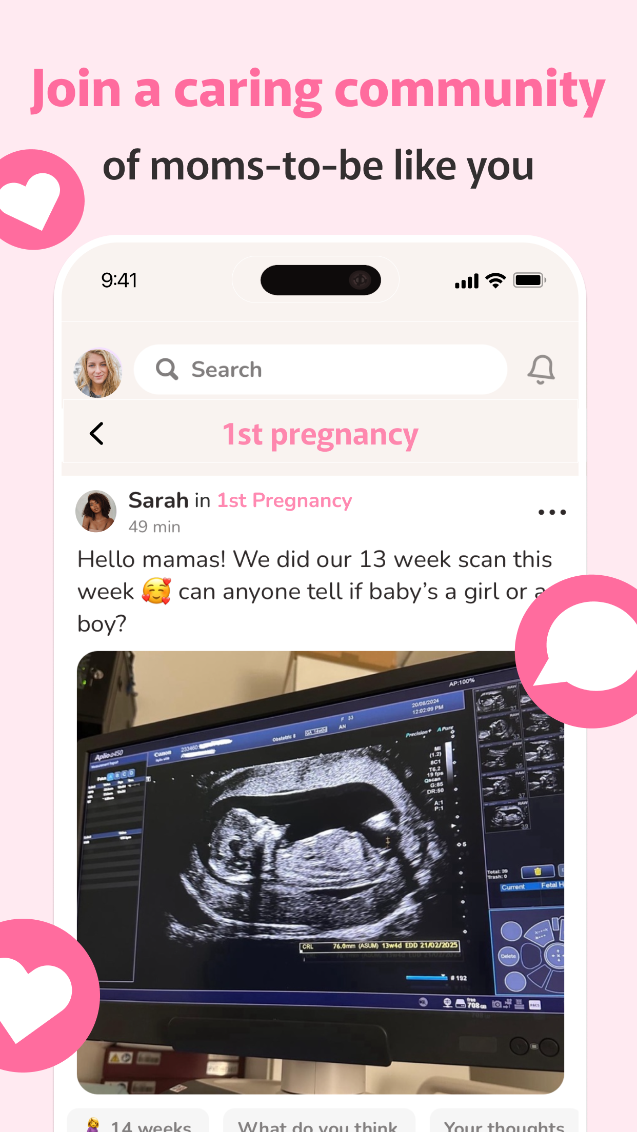 Pregnancy & Baby App: WeMoms screenshot 6