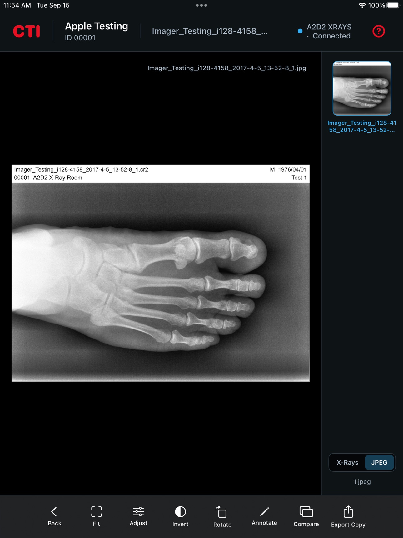 Screenshot 6 of CTI A2D2 Remote X-Ray Viewer