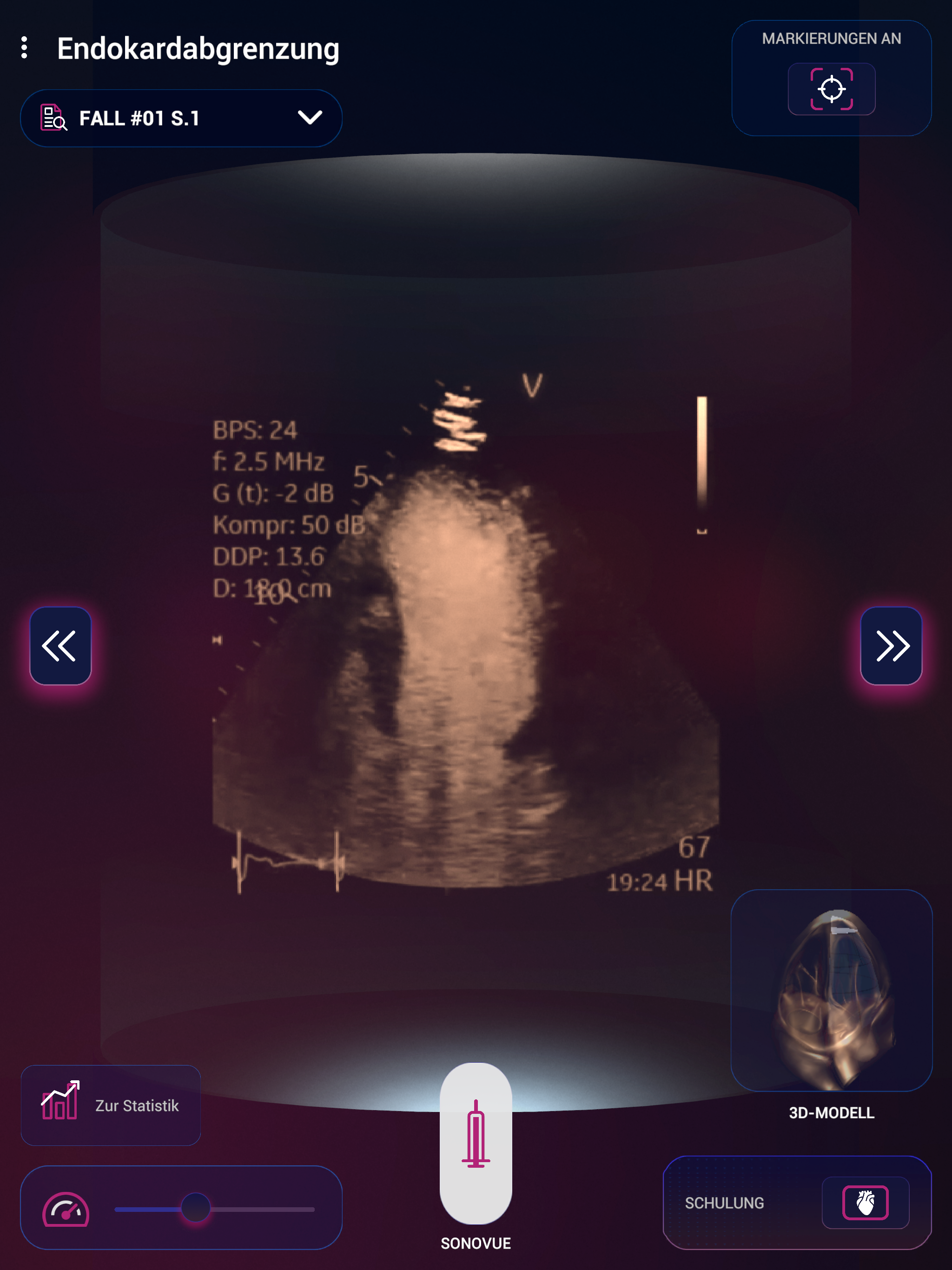 SonoVue screenshot 12