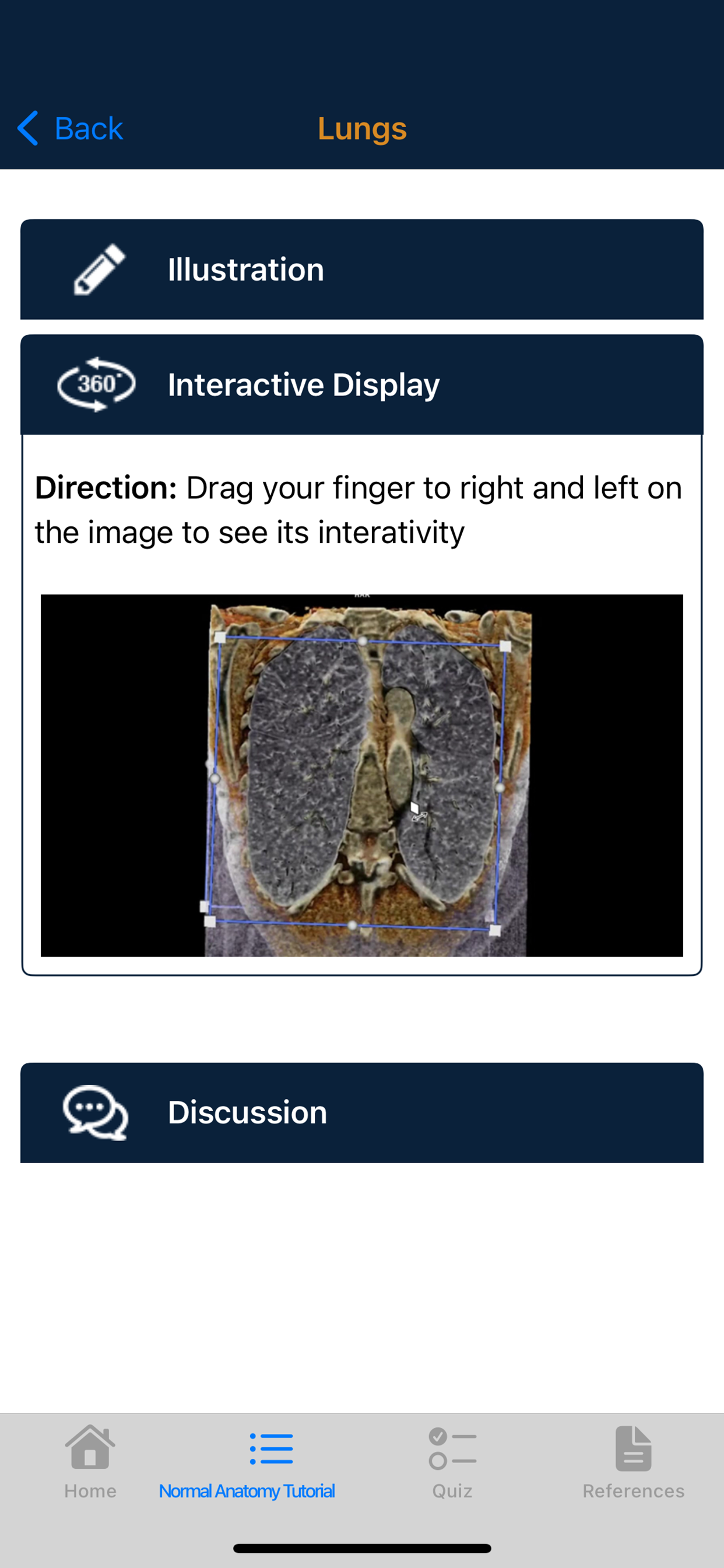 CTisus Chest Atlas 3D CRT