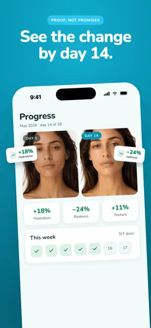 AI Skincoach screenshot 3