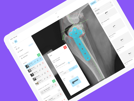 VPOP® PRO iPad screenshot 2 - Medical app