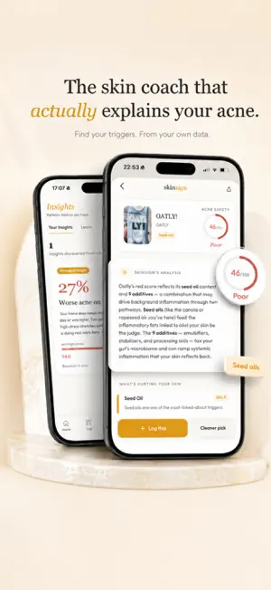 Skinsign: Acne Coach & Scanner screenshot 1