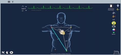 Heart Simulator - App de Educación | MWM
