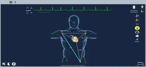 Heart Simulator - App de Educación | MWM