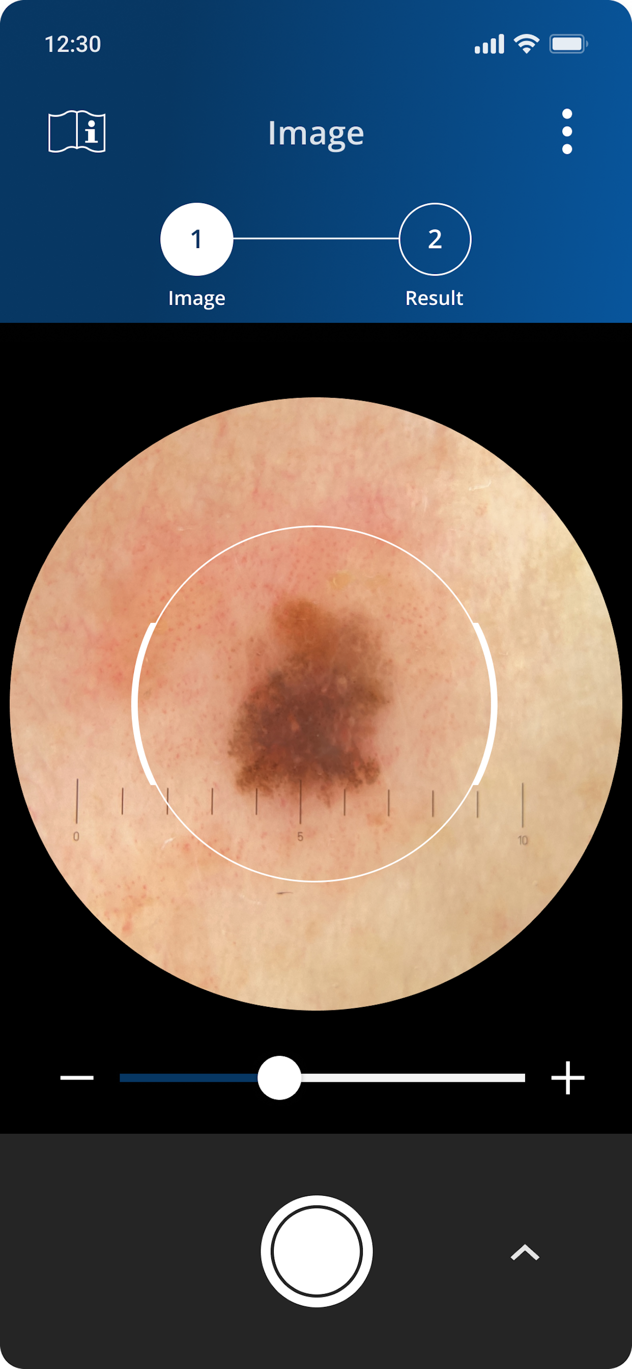 Dermalyser screenshot 5