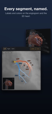 AngioView screenshot 2