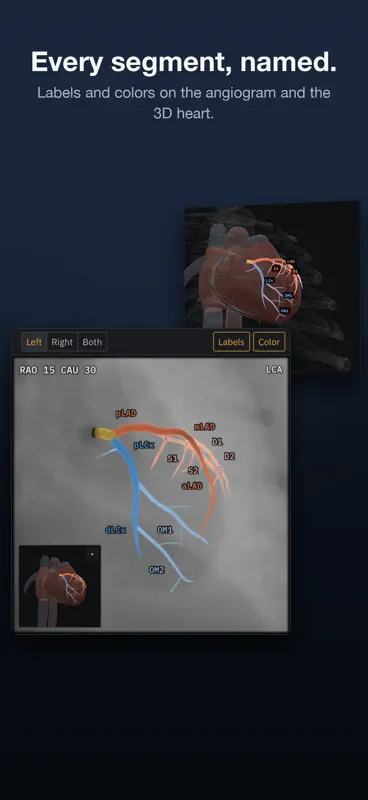 AngioView screenshot 2 of 5