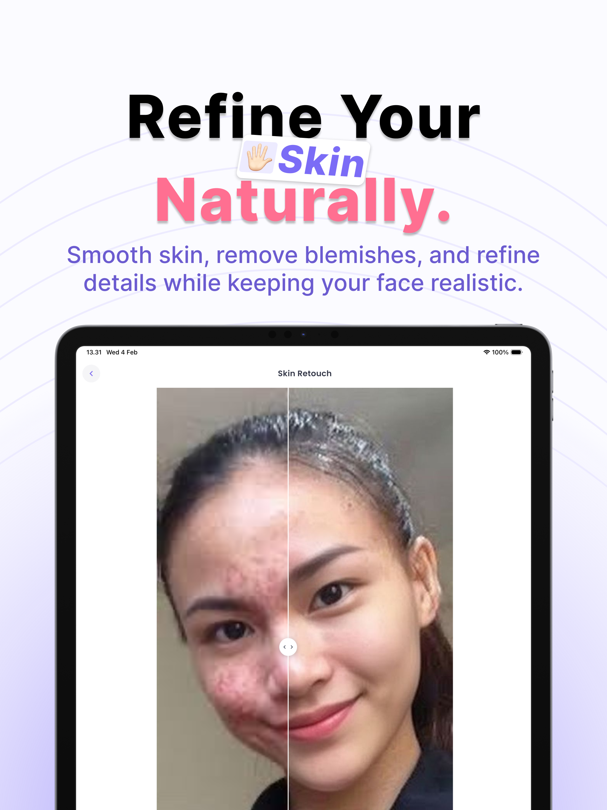 Skinova: Photo Editor & Filter