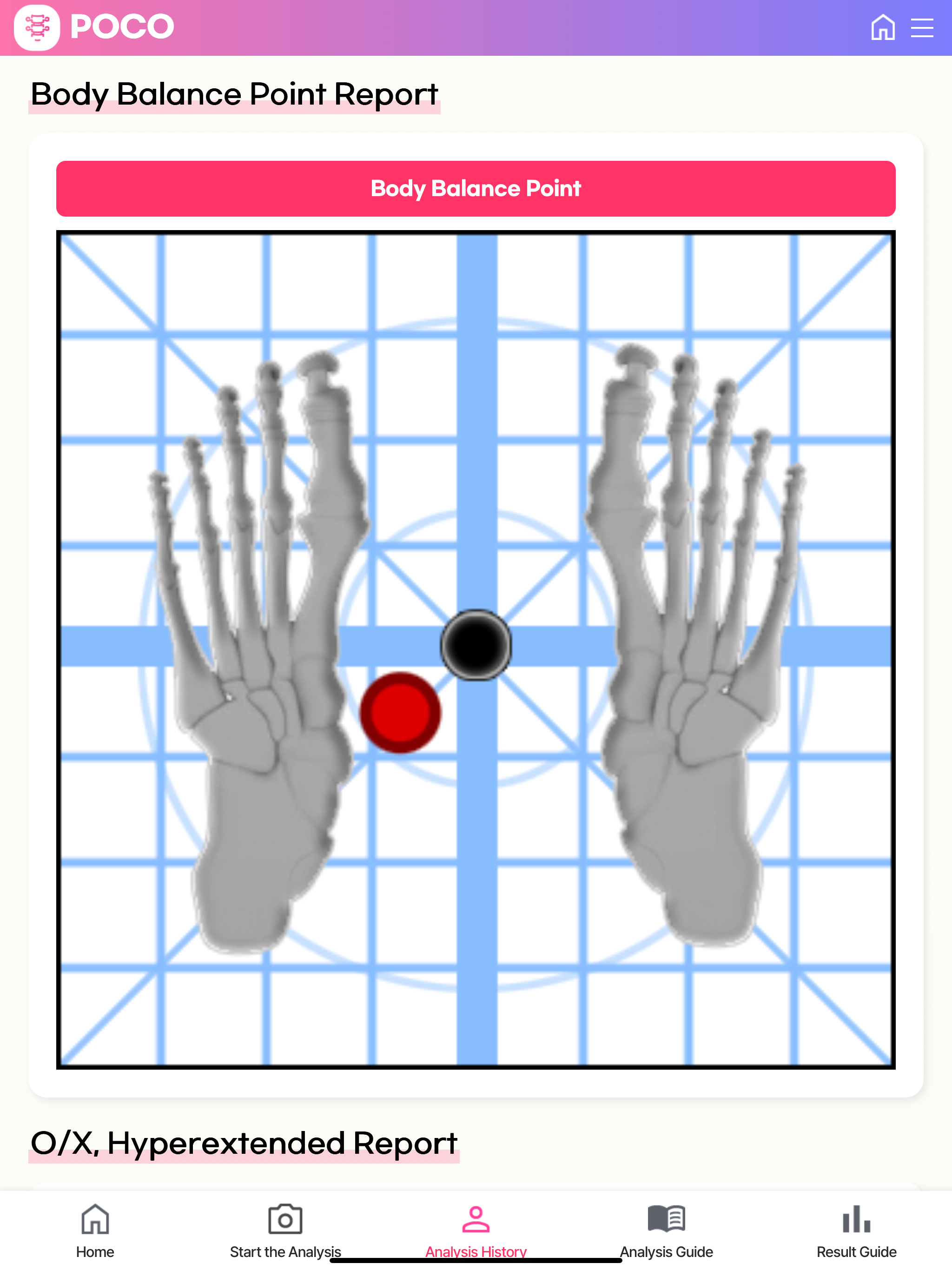 AI Posture Analysis