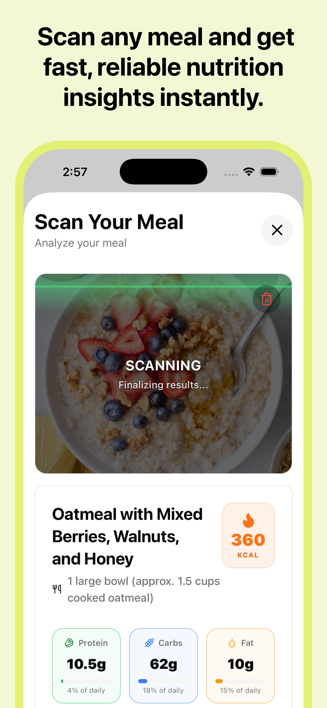 NutriSnap: Calorie & Macro