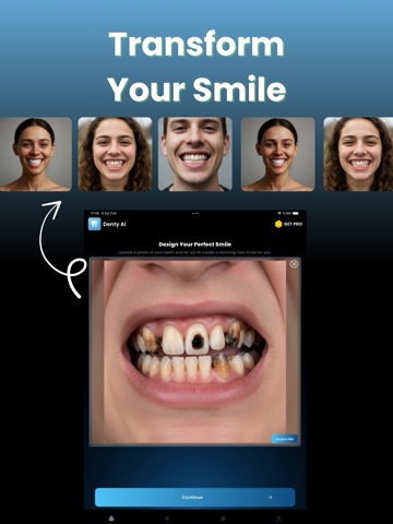 Denty : AI Teeth Designer iPad screenshot