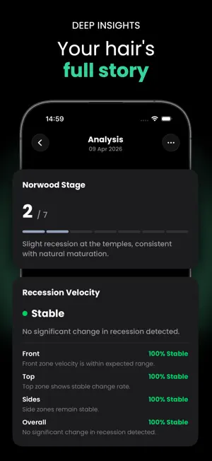 HairKit: Hair Loss Tracker screenshot 4