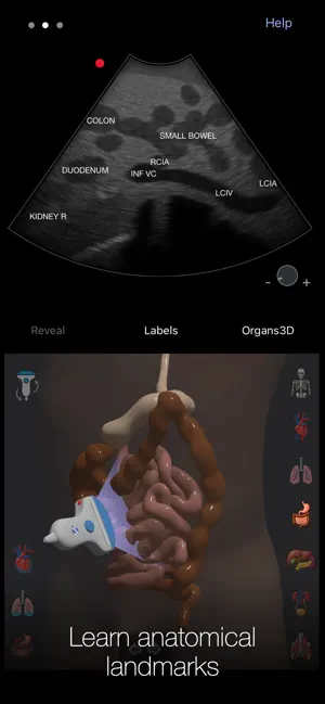 PoCUS Pocket Trainer screenshot 2