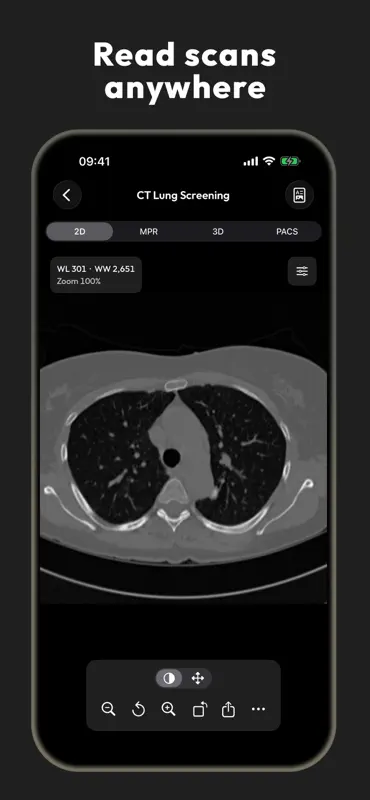 DICOM Viewer - MesDICOM screenshot 5 of 8