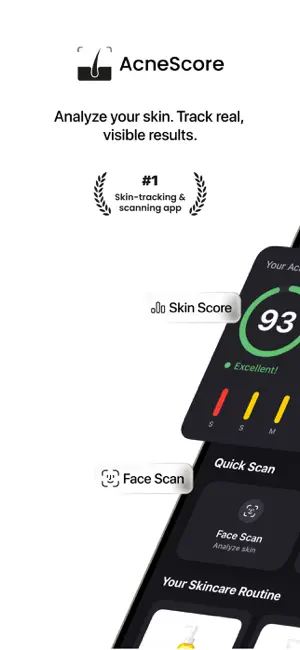 AcneScore | Identify Triggers screenshot 1