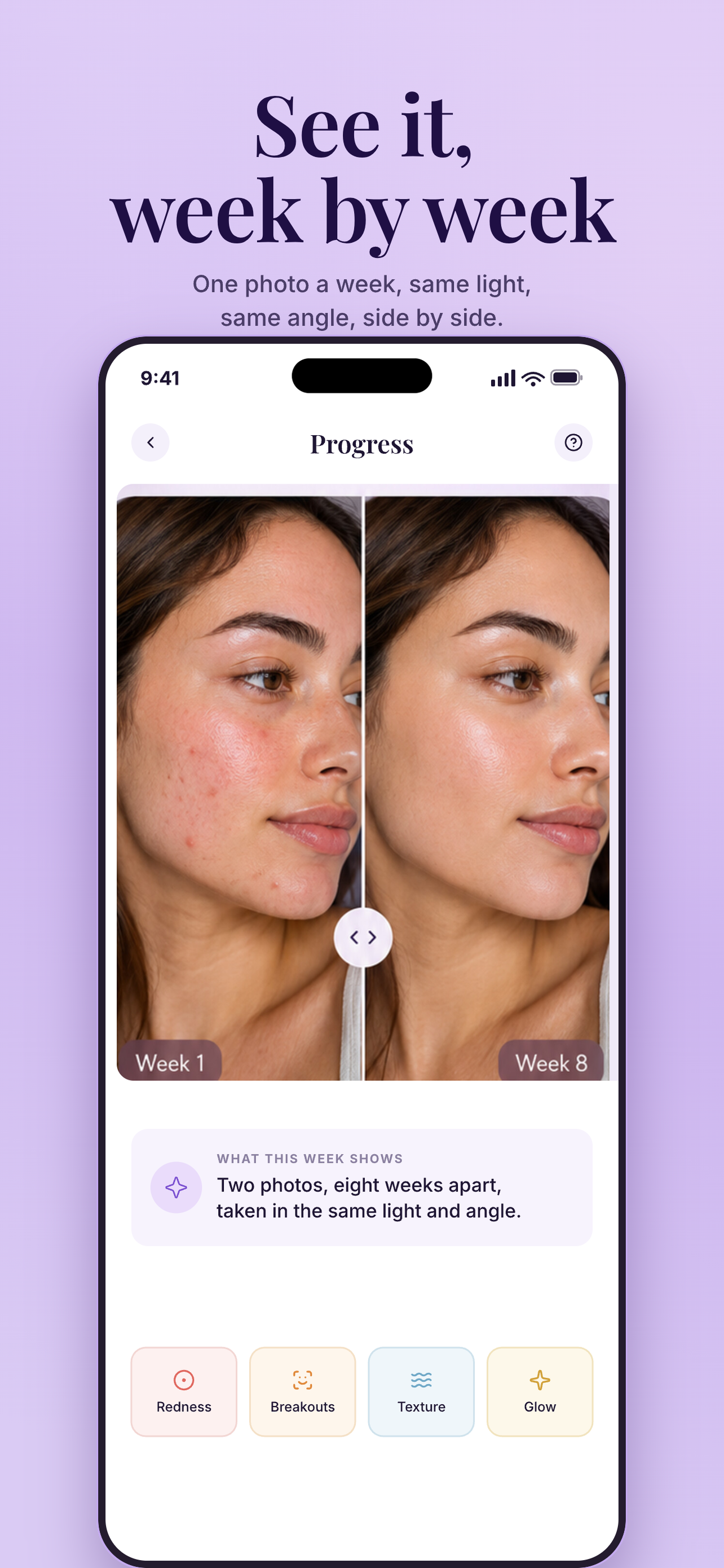 SkinCare AI: Skin Coach screenshot 3