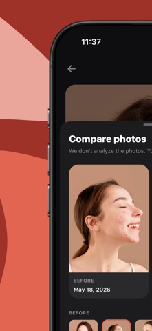 Acne Tracker: Skin Journal Screenshot 4 of 10