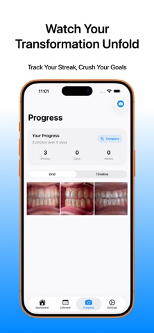 Aligner Snap screenshot