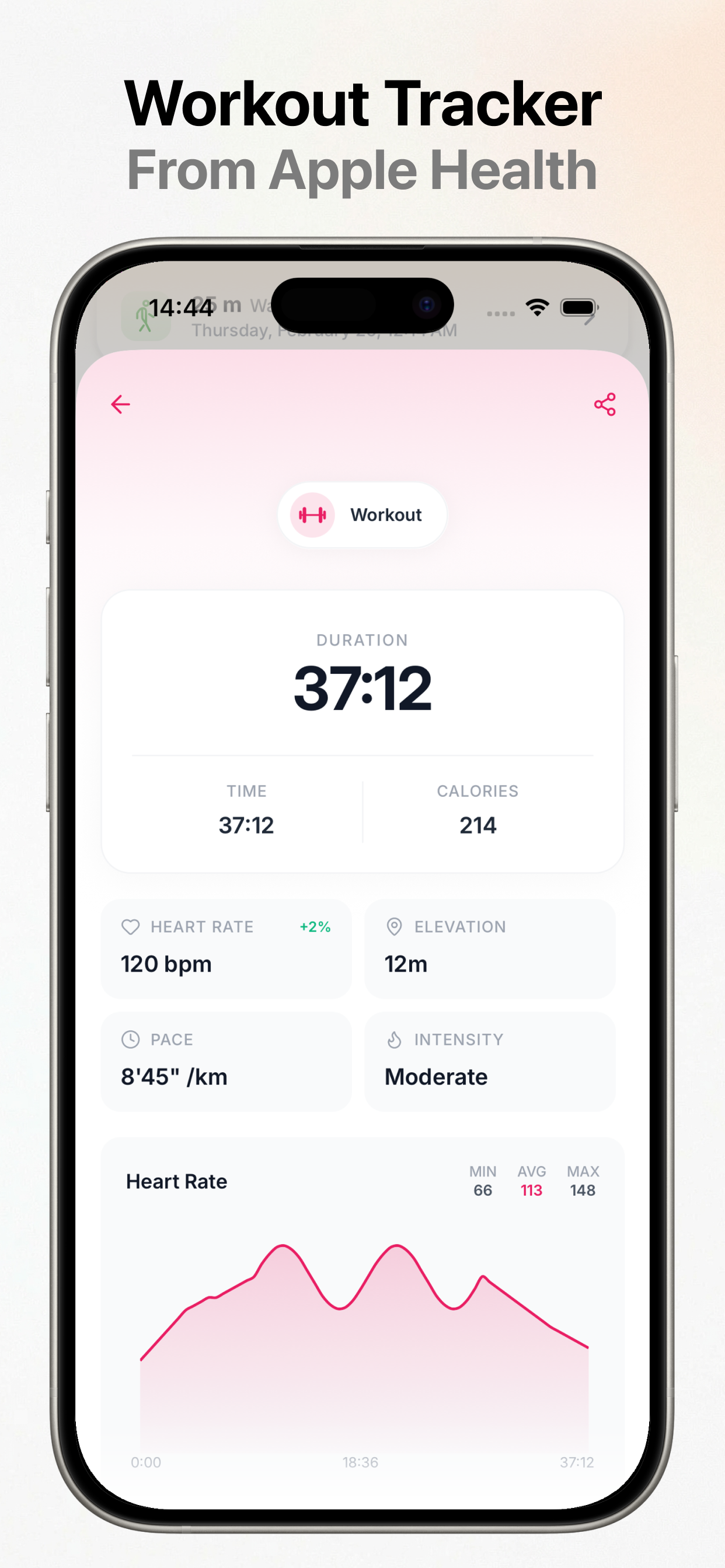 Zuppy: AI Calorie Counter