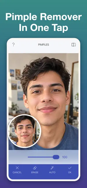 Face Editor: AI Pimple Remover screenshot 1