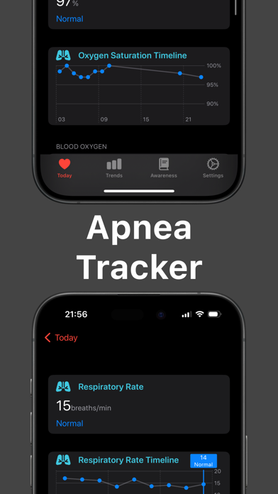 CardioBot: Heart Rate Monitor