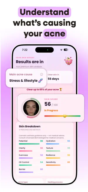 AntiAcne - Your Acne Journey screenshot 3