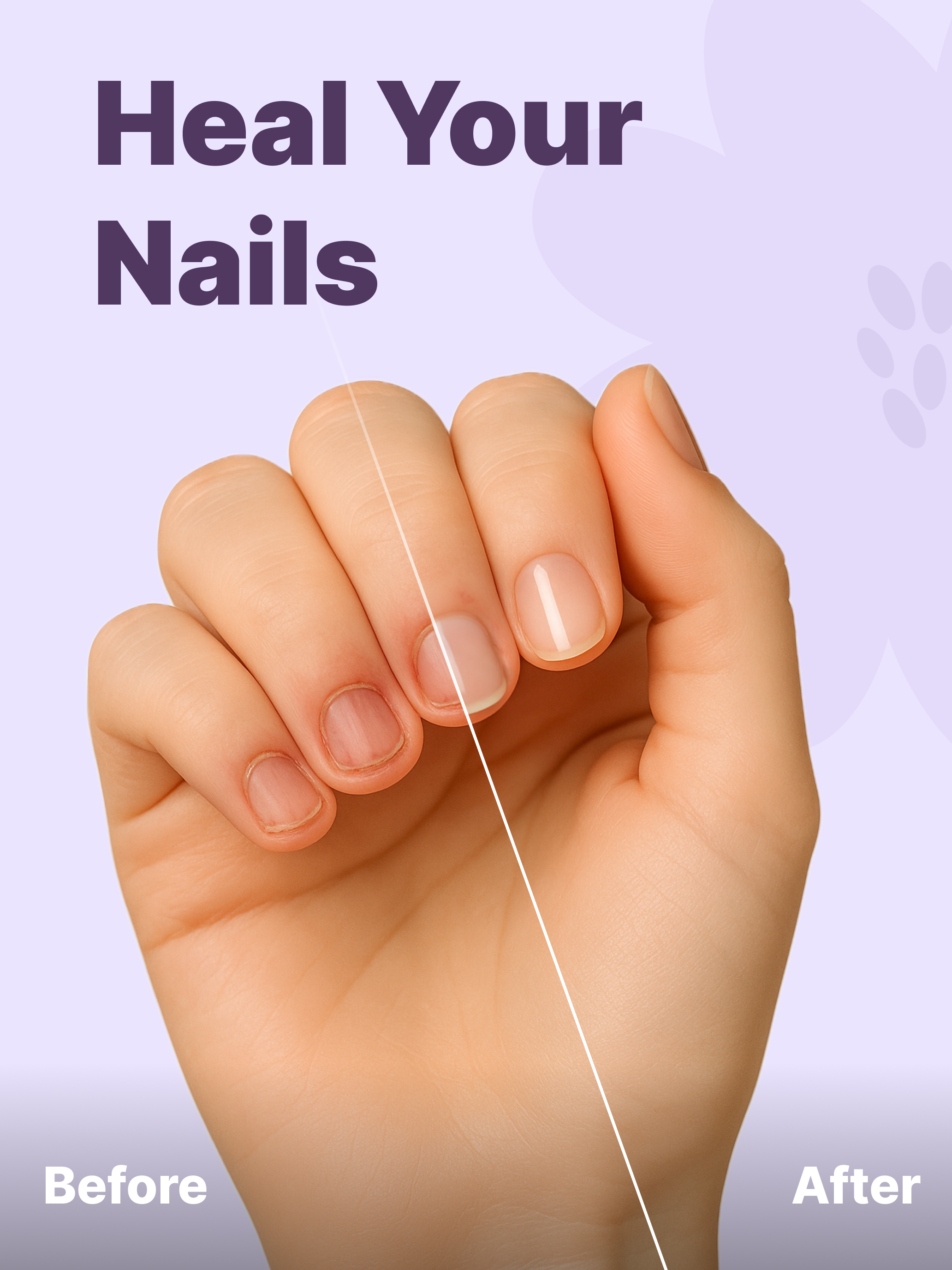 Unbite: Stop Nail Biting screenshot 7