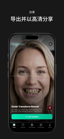 DentalReels: 牙齿视频制作 screenshot