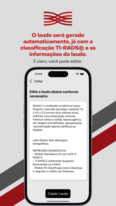 TI-RADS Calc Screenshot