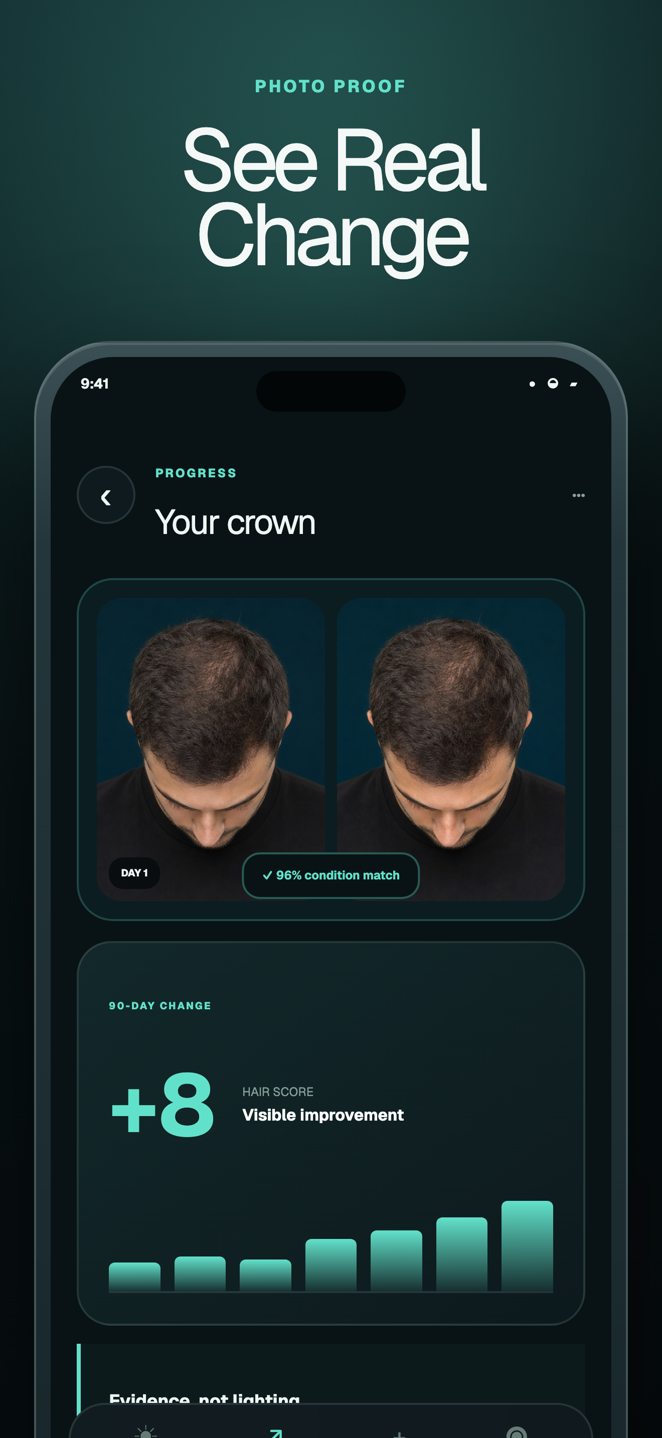 BaldAI: Hair Loss Tracker screenshot 2