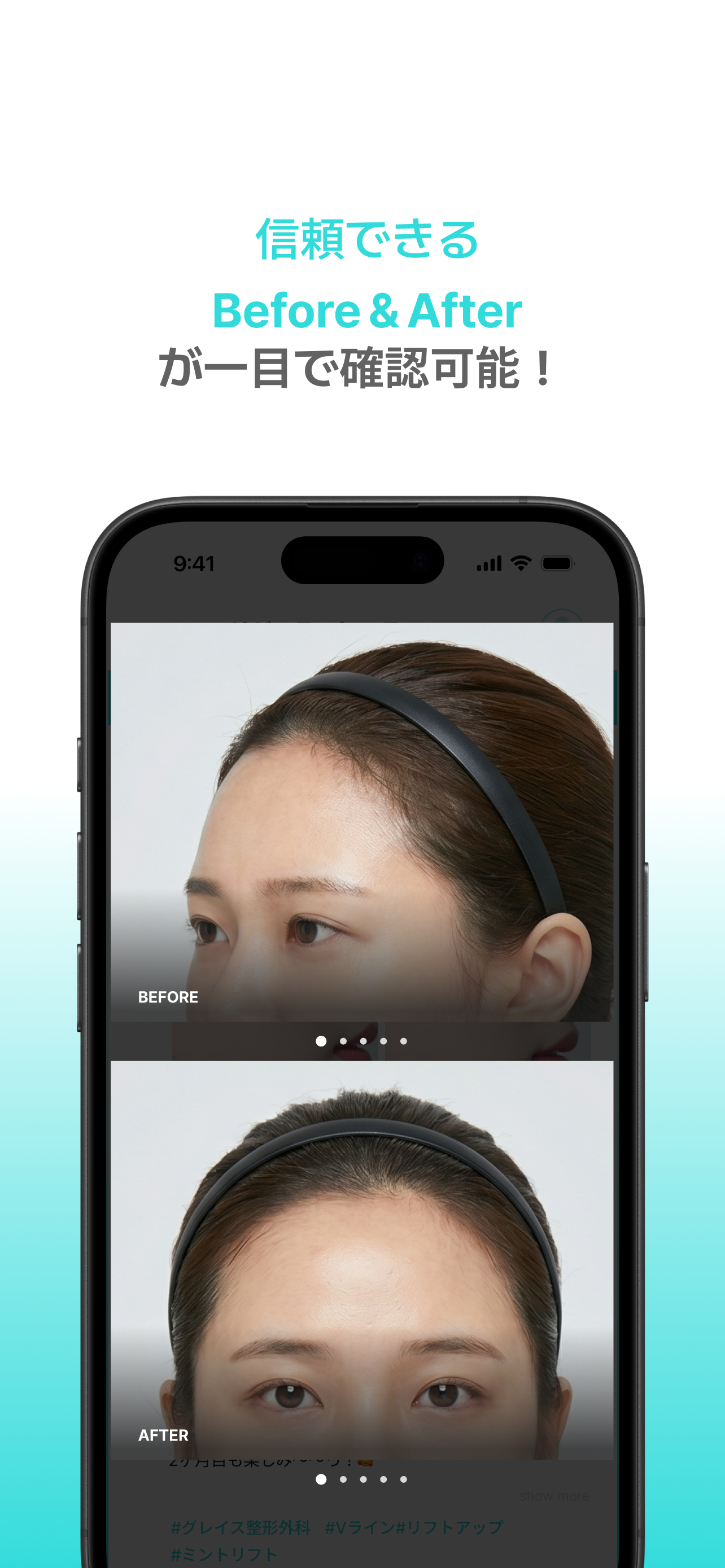 Miview screenshot 4