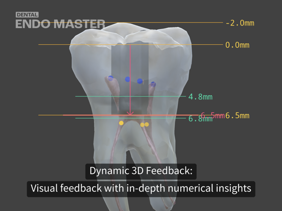 Dental EndoMaster iPad screenshot 7 - Medical app