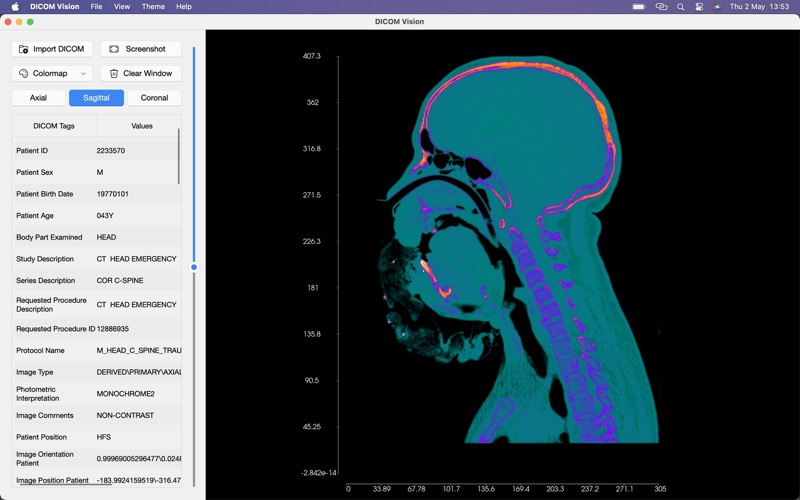 DICOM Vision Screenshot