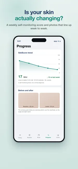 Seborrheic: Dermatitis Tracker screenshot 3
