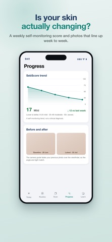 Seborrheic: Dermatitis Tracker Screenshot 3 of 8